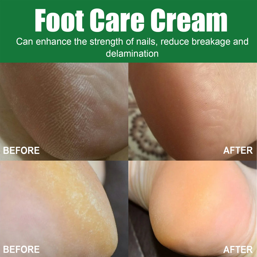 OCEAURA Foot Care Cream, Heel Moisturizing Skin Anti-Crack Repair Nail Foot Care Cream