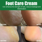 OCEAURA Foot Care Cream, Heel Moisturizing Skin Anti-Crack Repair Nail Foot Care Cream