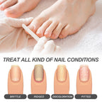 Oceaura Nail Care Essence, Moisturizing, Brightening And Strengthening Essence For Repairing Broken Nails