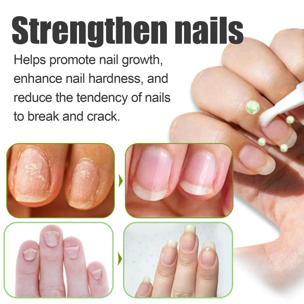 Oceaura Nail Care Essence, Moisturizing, Brightening And Strengthening Essence For Repairing Broken Nails