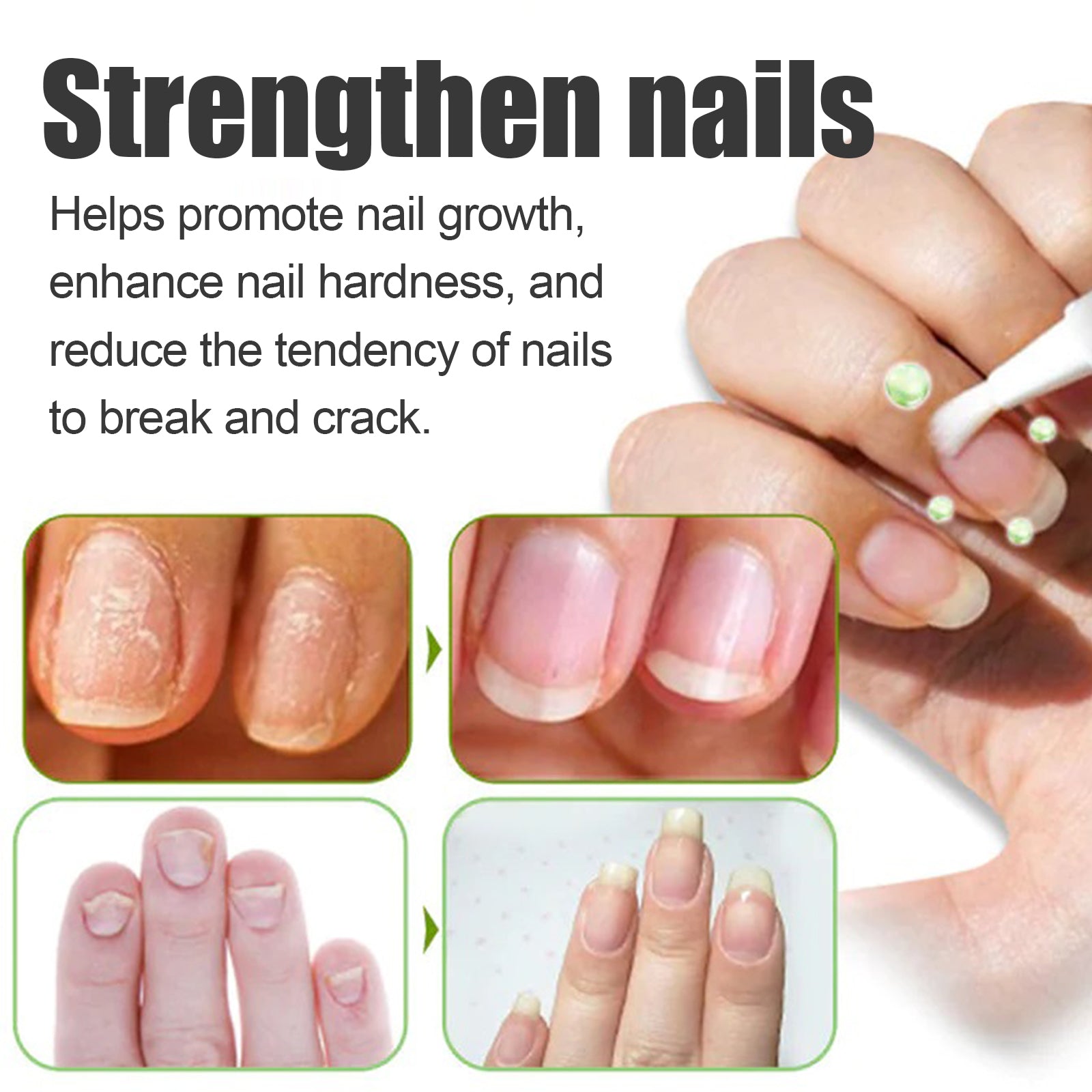 Oceaura Nail Care Essence, Moisturizing, Brightening And Strengthening Essence For Repairing Broken Nails