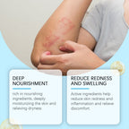 OceAura Skin Repair Cream, Nourishes Skin Daily Care For External Application Of Delicate Skin Care Cream