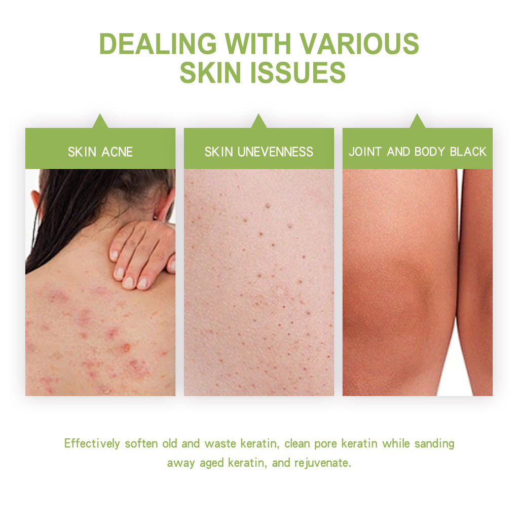 OCEAURA Avocado Body Exfoliating Scrub, Clear Skin Exfoliating Dead Skin Smooth And Brightening Skin Scrub