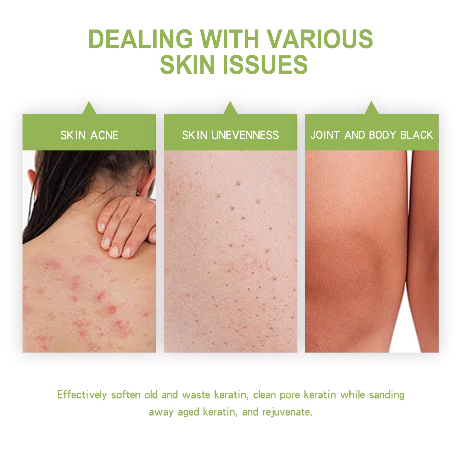 OCEAURA Avocado Body Exfoliating Scrub, Clear Skin Exfoliating Dead Skin Smooth And Brightening Skin Scrub