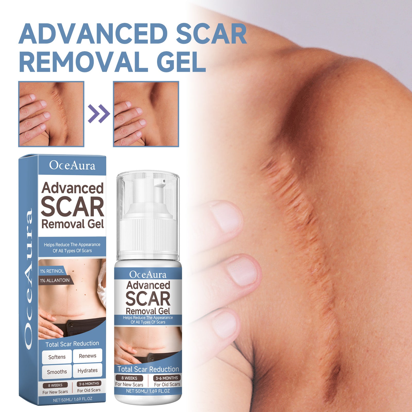 Oceaura Scar Whitening Repair Gel Moisturizes And Smooths Skin Repair Surgery Scar Pregnancy Care Gel